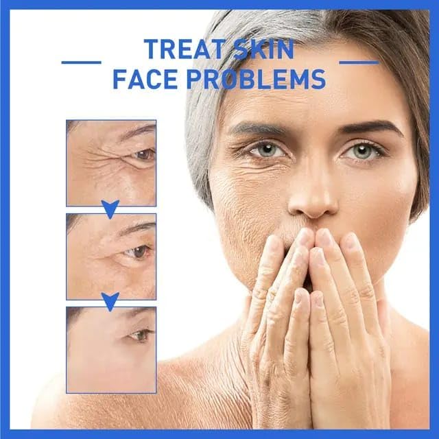 Botox Anti-Aging Serum (Buy 1 Get 1 FREEš„)