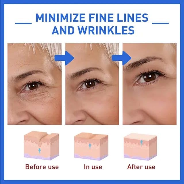 Botox Anti-Aging Serum (Buy 1 Get 1 FREEš„)